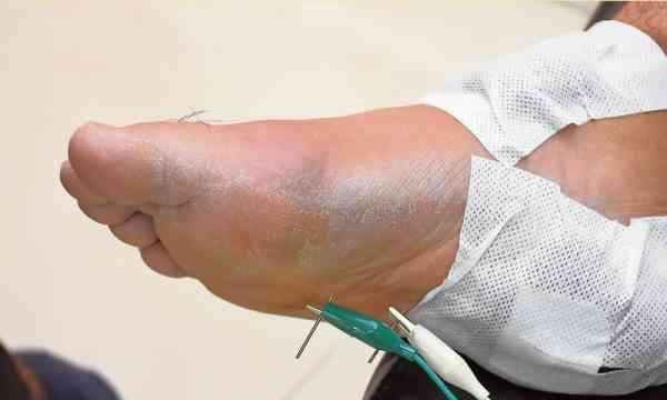 用钢针扎进电池为什么会爆炸？这种行为有哪些危害？  第2张